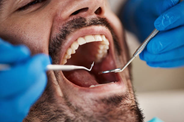 Best Emergency Root Canal Treatment in Knik Fairview, AK