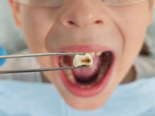 Best Emergency Treatment for Toothache in Knik Fairview, AK